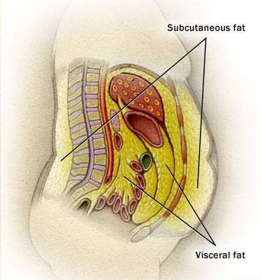 Visceral fat: What is it, Why it’s dangerous & how to reduce it